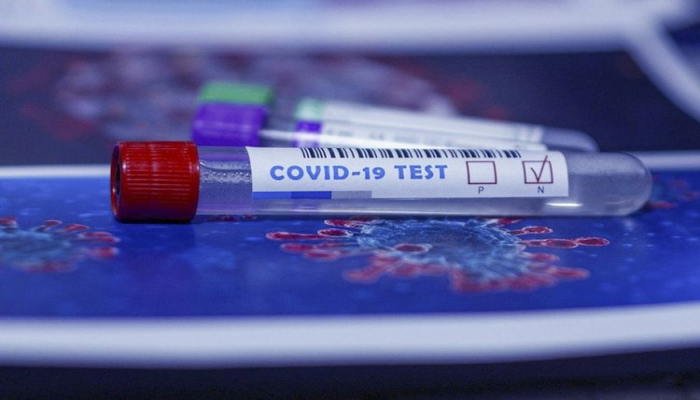 Azərbaycanda indiyədək aparılan koronavirus testlərinin sayı açıqlanıb