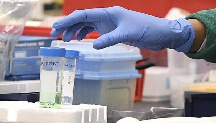 ÜST Koronavirus üçün peyvəndin hazır olacağı tarixi AÇIQLADI