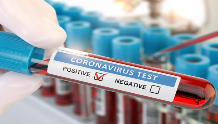 Azərbaycanda daha 67 yeni nəfər koronavirusa yoluxub, 2 nəfər ölüb
