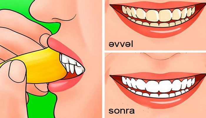 Banan qabığını sağlamlıq və gözəlliyiniz üçün belə istifadə edin