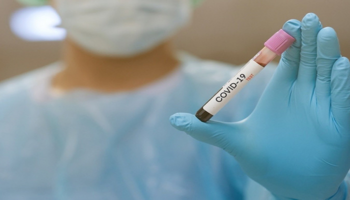 Azərbaycanda daha 33 nəfər koronavirusa yoluxub, 23 nəfər sağalıb