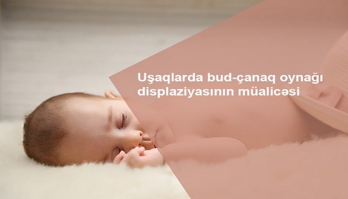 Uşaqlarda bud-çanaq oynağı displaziyası haqda bilmədikləriniz