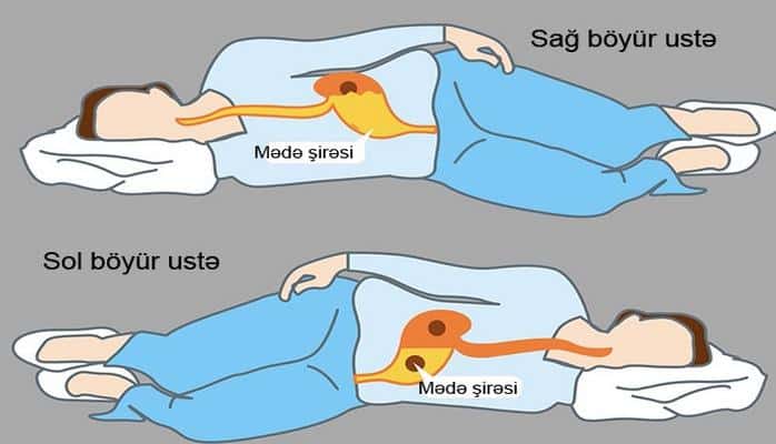 Nə üçün sol böyür üstə yatmaq lazımdır?