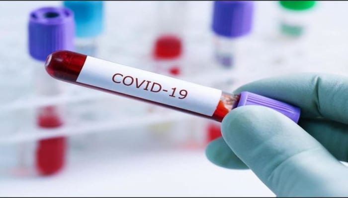 İsveçrədə koronavirusa yoluxanların sayı kəskin artdı