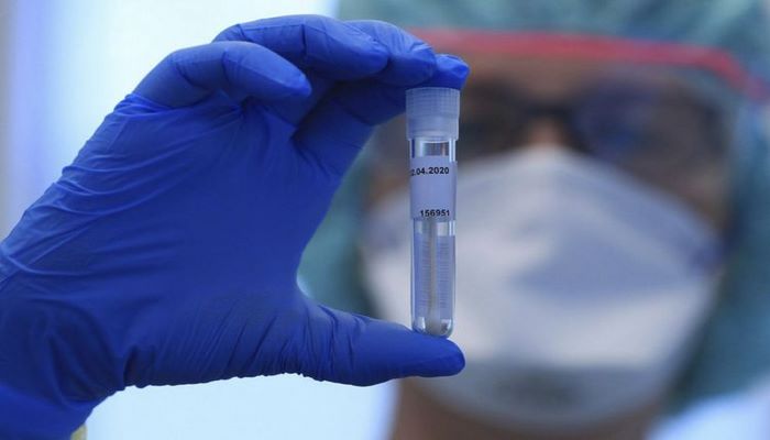 Azərbaycanda indiyədək 537 230 koronavirus testi aparılıb