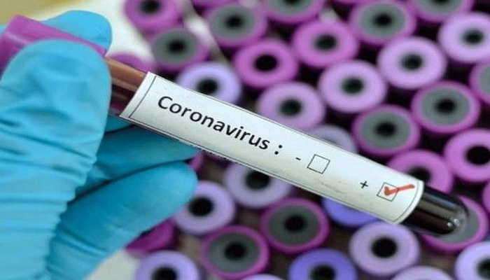 Azərbaycanda koronavirusa yoluxanların sayı kəskin artdı: Çox sayda ölən var
