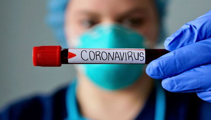 Azərbaycanda son sutka ərzində 18 nəfər koronavirusdan ölüb