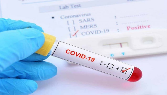 Azərbaycanda daha 49 nəfərdə koronavirus aşkarlandı - 1 nəfər öldü, 46 nəfər sağaldı