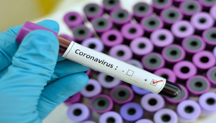 Bu gün Azərbaycanda koronavirusa görə 5 745 test aparılıb - STATİSTİKA