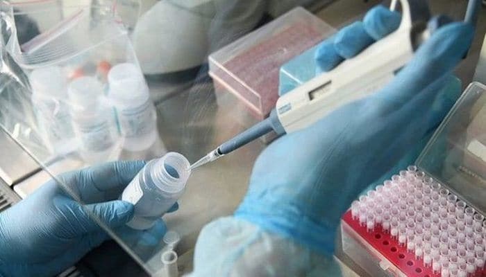 Tullantı sularında koronavirus qalıqları tapıldı