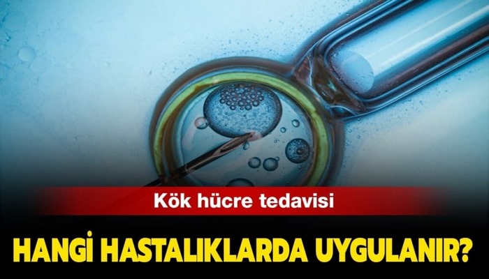 Kök hücre tedavisi hangi hastalıklarda uygulanıyor?