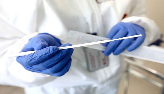 TƏBİB: “Koronavirus testlərinin qiymətlərinə qarışmırıq”